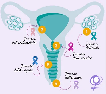 tumore grandi labbra (vulva) immagini